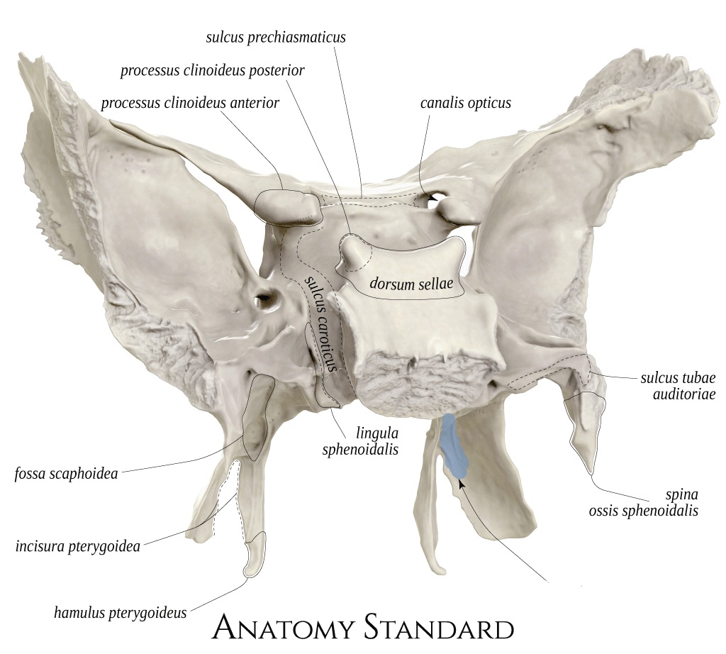 term image