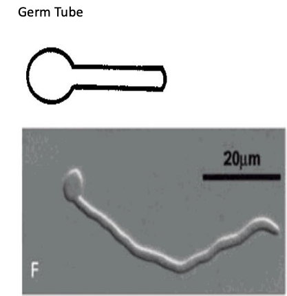 <p>Below is an image of a germ tube result. ID the organism </p>