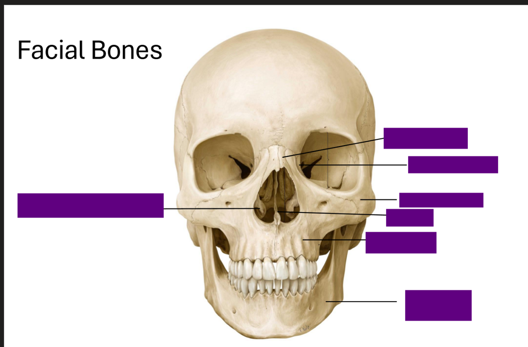 <p>Label the Facial Bones</p>