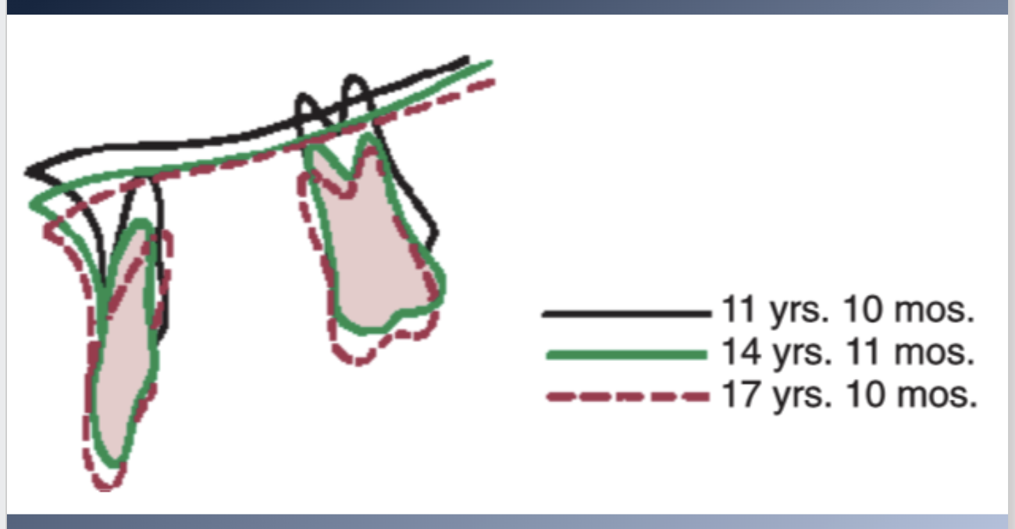 <p><span>1. Functional processes</span><br><span>1. Alveolar process</span><br><span>2. No areas of muscle attachment analogous to those of the mandible</span><br><span>3. Function of respiration: Parts of the bone surrounding the air passages</span><br><span>2. Core of the maxilla</span><br><span>1. Small and variable degree of rotation (forward/backward)</span><br><span>3. Matrix rotation is not possible for the maxilla</span></p>