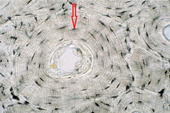<p>small cavities that contain osteocytes</p>