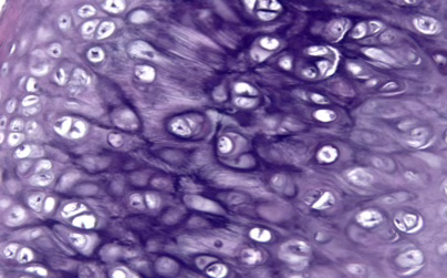<p>Elastic Cartilage</p>