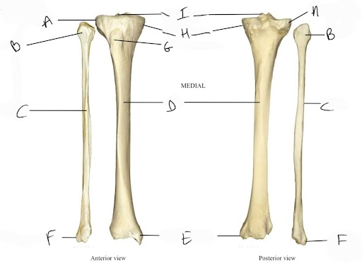 <p>head of fibula</p>
