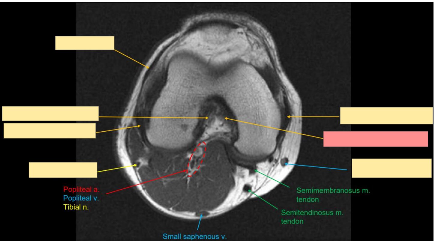 <p>Identify the structure</p>