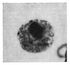 <p>This is a picture of a nucleus what is the dark spot with in the nucleus called?</p>
