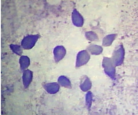 <ul><li><p>trophozoite </p></li><li><p>causes balantidiasis </p></li></ul><p></p>
