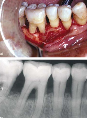 <p>root trunk length</p>