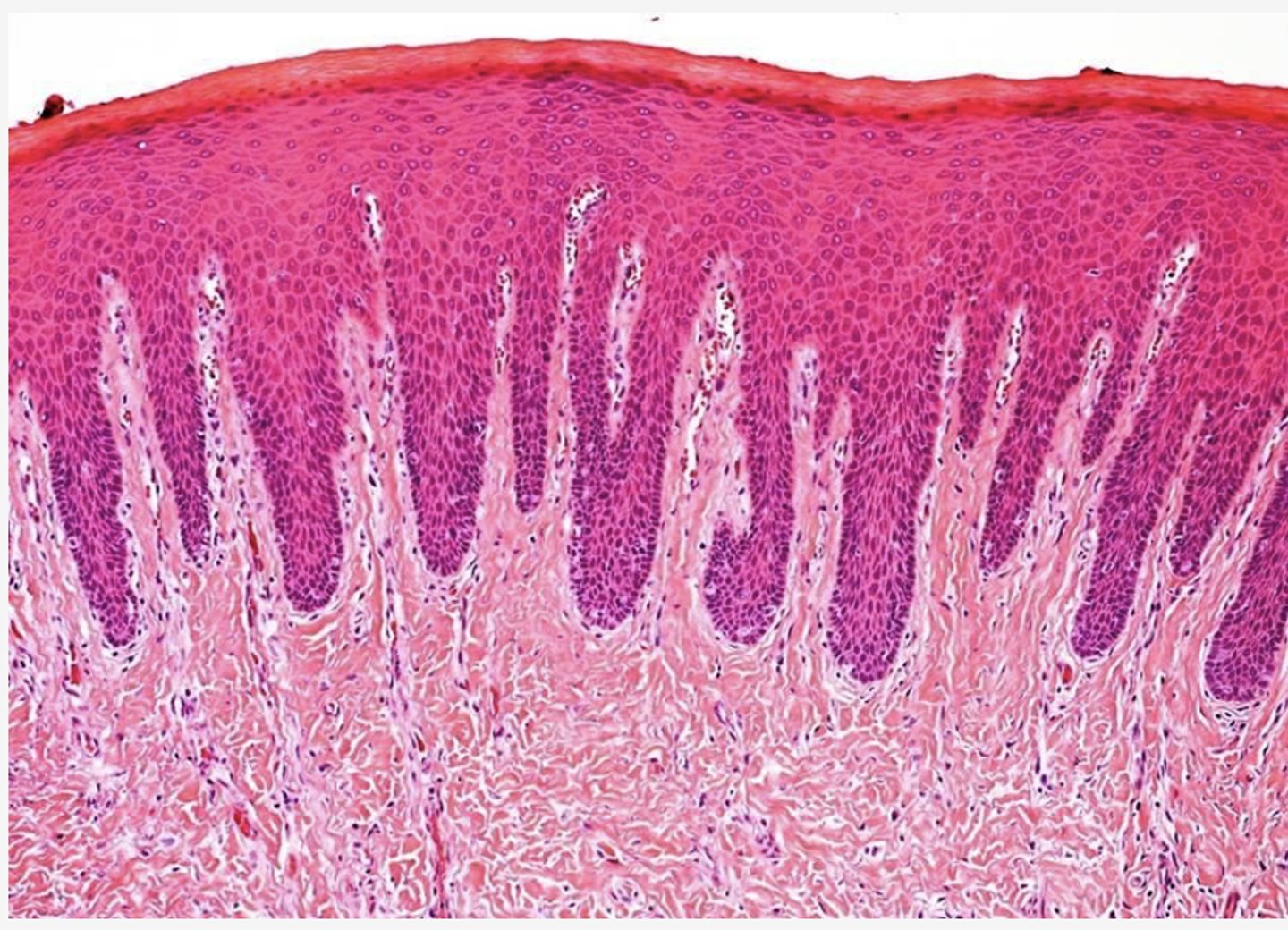 <p>Identify the mucosa</p>