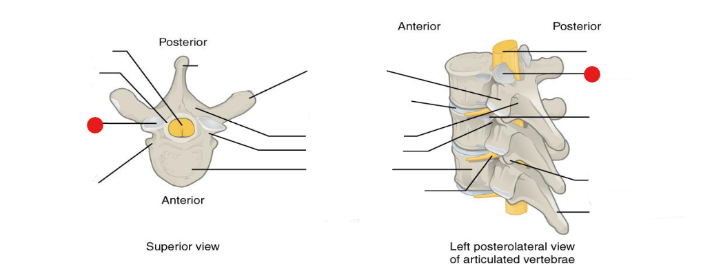 <p>Identify the structure pinned</p>