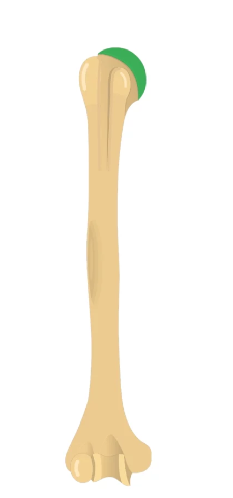<p>What is this pointing to? What bone is it on?</p>