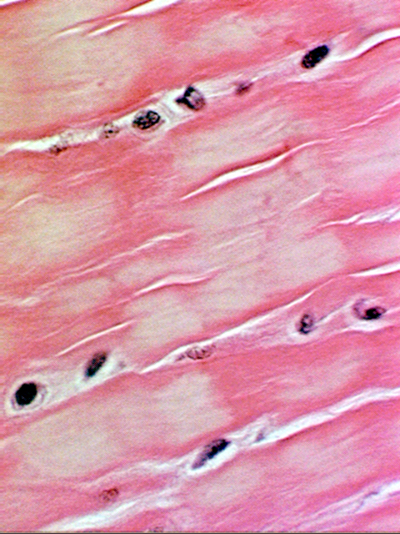 <p>Fibrocartilage</p>
