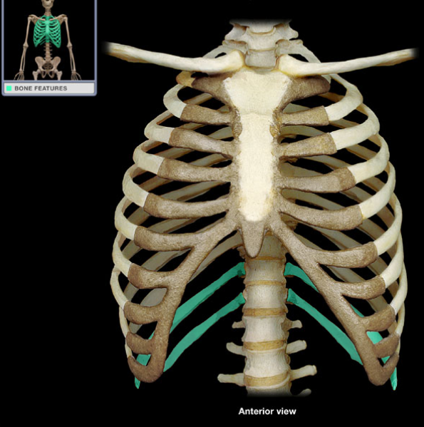 <p>What is the name of this structure?</p>