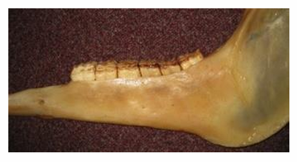 <ul><li><p>Curving upwards of cheek teeth </p><ul><li><p>take care when trying to remove caudal 11 overgrowths </p></li></ul></li><li><p>More pronounced in Arabs</p></li></ul><p></p>