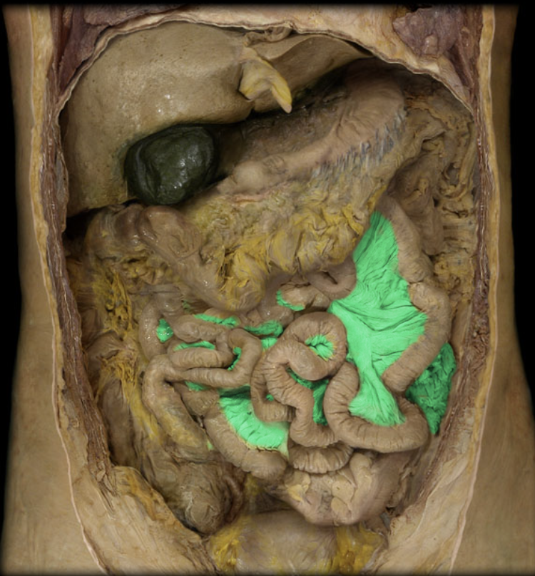 term image