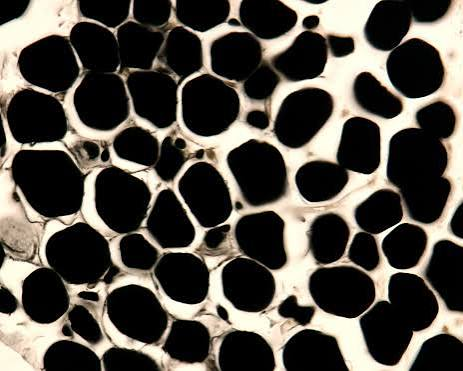 <ul><li><p>cytoplasm cannot be stained with eosin but rather hematoxylin</p></li><li><p>expensive</p></li><li><p>slow penetration</p></li></ul><p></p>
