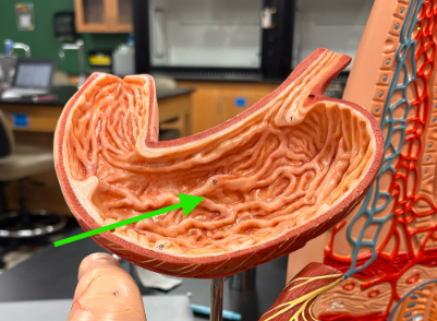 <p>What is the arrow pointing at?</p>