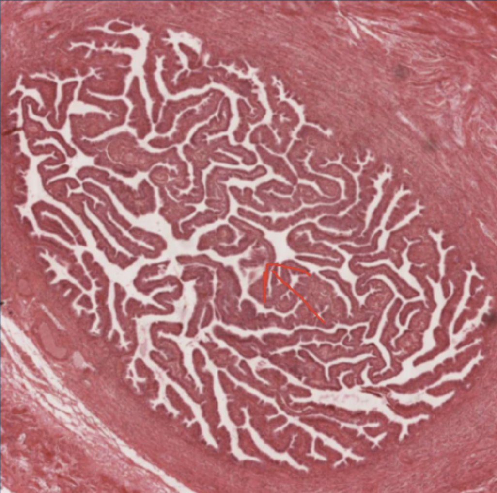 <p>whole structure</p>