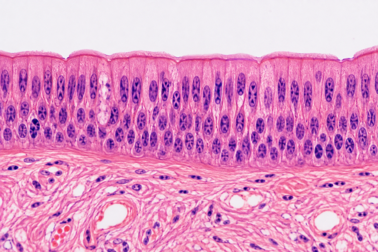 <p>What type of Epithelial Tissue is this?</p>