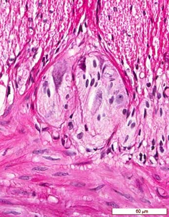 <p>Identifica la plaquita</p>