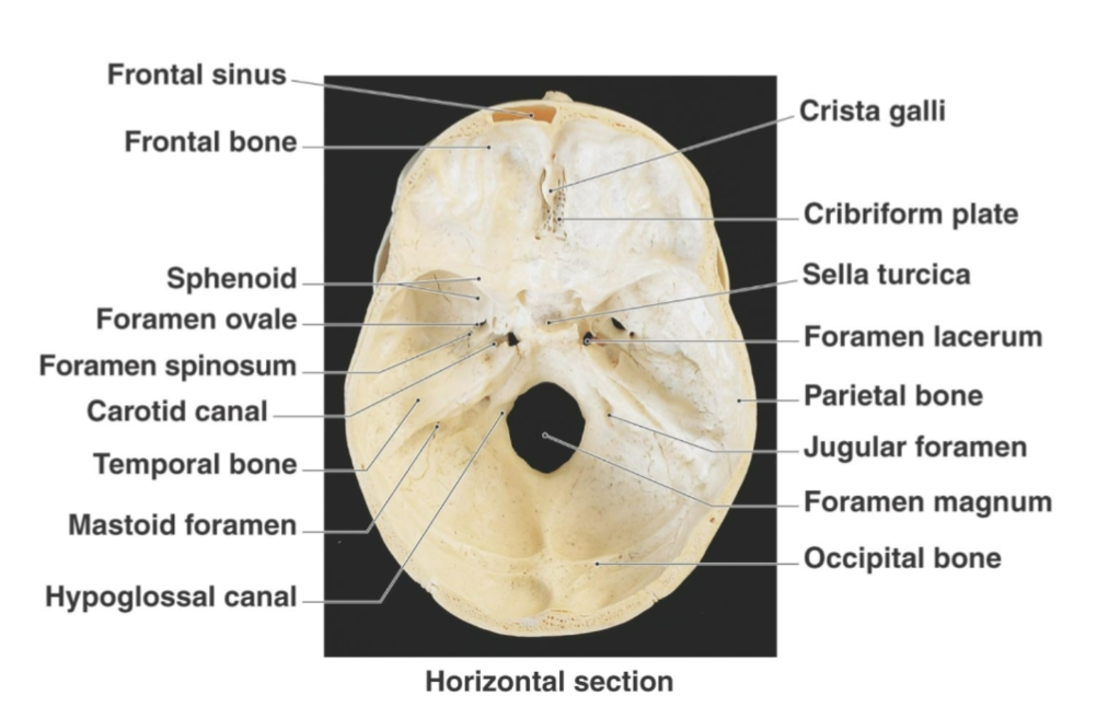 <p><strong>Passageway</strong> for the <strong>internal carotid artery </strong>within temporal bone</p>