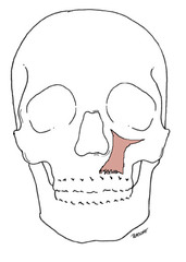 <p>lip/teeth exposed; elevates and protrudes upper lip (shows upper teeth)</p>
