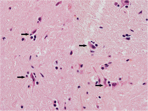<p>PANLEUKOPENIA</p>