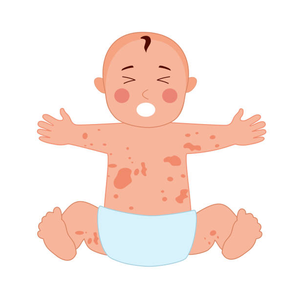 <p>Neonatal skin findings</p>