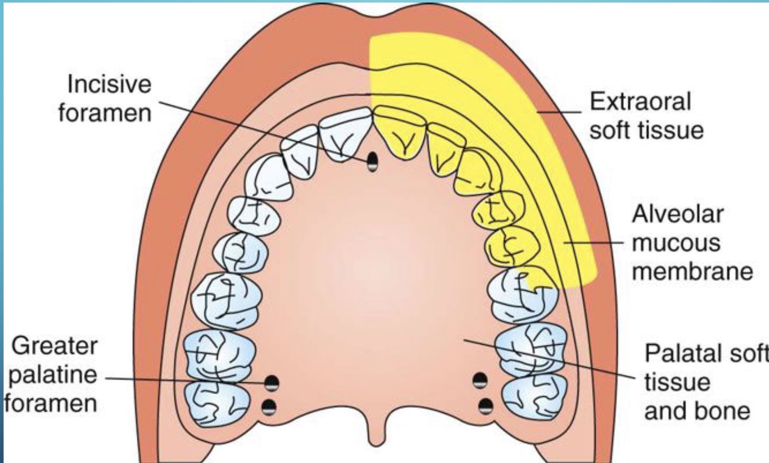 <p>pulps of: central incisor, lateral incisor, canine</p><p>in about 72% of patients, also: premolars, MB root of first molar</p><p>also anesthetizes: buccal bone and periodontium, lower eyelid, lateral nose, upper lip</p>