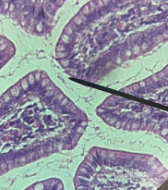 <p>Location: Stomach, Intestines, Gallbladder, Uterus, ect.</p><p>Function: <span style="background-color: transparent;">Helps in the absorption of nutrients and the secretion of mucus and digestive enzymes</span></p><p><span style="background-color: transparent;">Epithelial Tissue</span></p>