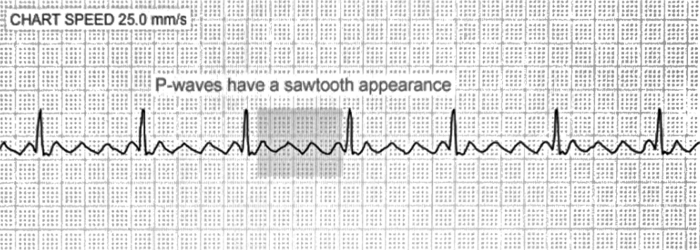 <p>Sawtooth flutter waves</p>
