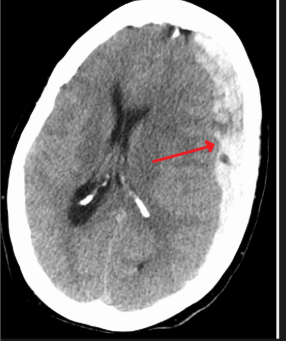 <p>what is the diagnosis?</p>