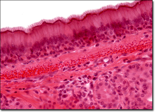 <p>Pseudostratified Columnar Epithelium</p>