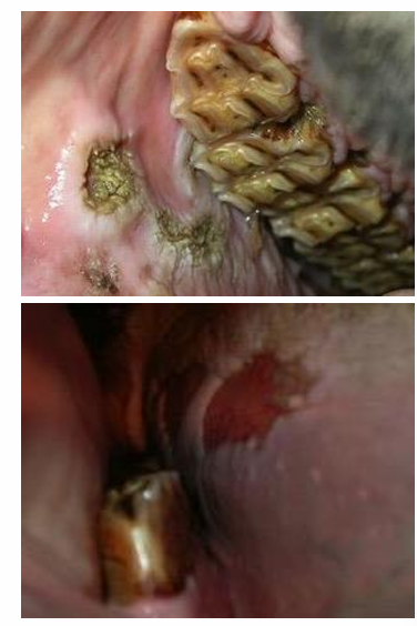 <ul><li><p>Quidding, pain when eating, +/- colic</p></li><li><p>Tack may exarcerbate</p></li><li><p>More pronounced when horses fed more concentrate bc unnatural masticatory pattern</p></li><li><p>Tack may exacerbate problem —> mucosal ulceration </p></li></ul><p></p>