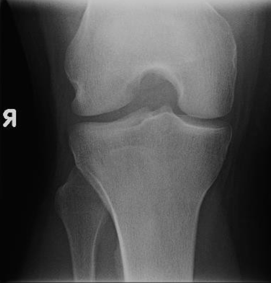 <p>What projection of teh knee is this</p>