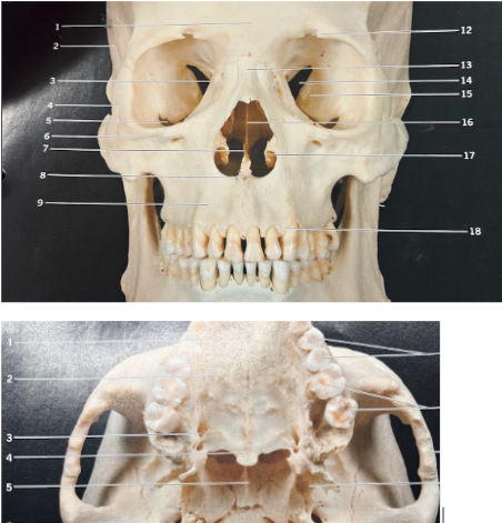 <p>What is 5 & 7 (same structure)</p>