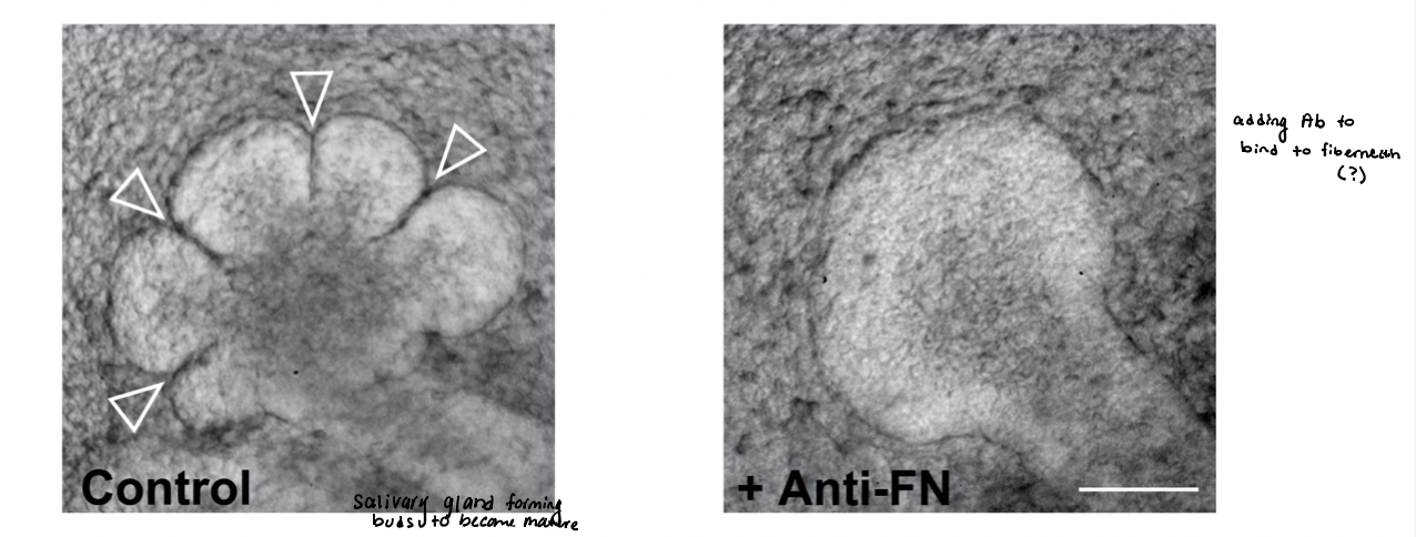 <p>disruptions in cell-matrix and cell-cell interactions interfere with tissue development </p><ul><li><p>experiment: </p><ul><li><p>immature salivary glands → isolated from murine embryos </p></li><li><p>undergo branching morphogenesis  in vitro for 10 hours </p></li><li><p>results: </p><ul><li><p>absence of added Ab → normal branching </p></li><li><p>presence of Ab (anti-FN) → blocks fibronectin activity </p></li></ul></li><li><p><em>conclusion</em> → <span style="color: rgb(255, 150, 150);"><strong><u>integrin-fibronectin interaction is required for branch formation </u></strong></span></p><ul><li><p>inhibition of integrin fibronectin receptor blocks branch formation </p></li></ul></li></ul></li></ul><p></p>