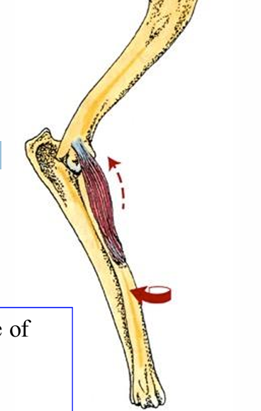 <p>Pronator teres m.</p>