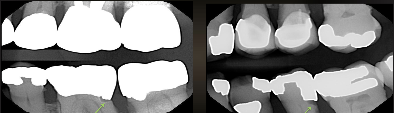 <p>what are these arrows pointing at?</p>