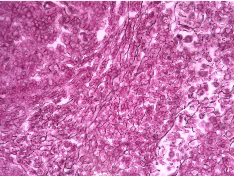 <p>what tissue is this </p>