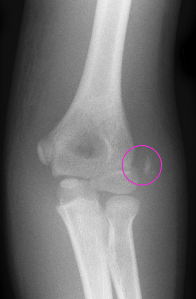 <p>What is the dx</p>