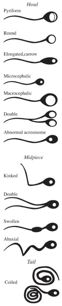 <p>Head:</p><ul><li><p>Pyriform</p></li><li><p>Round</p></li><li><p>Elongated</p></li></ul><ul><li><p>Microcephalic or macrocephalic</p></li><li><p>Double</p></li><li><p>Abnormal acrosmomes</p></li></ul><p>Midpiece</p><ul><li><p>Kinked</p></li><li><p>Double</p></li><li><p>Swollen</p></li><li><p>Abaxial</p></li></ul><p>Tail</p><ul><li><p>Coiled</p></li></ul><p></p>