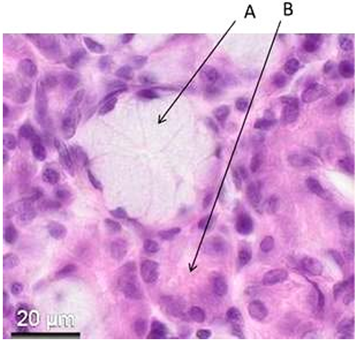 <p><strong>A6) Specify the type of secretory end piece indicated by A.</strong></p>