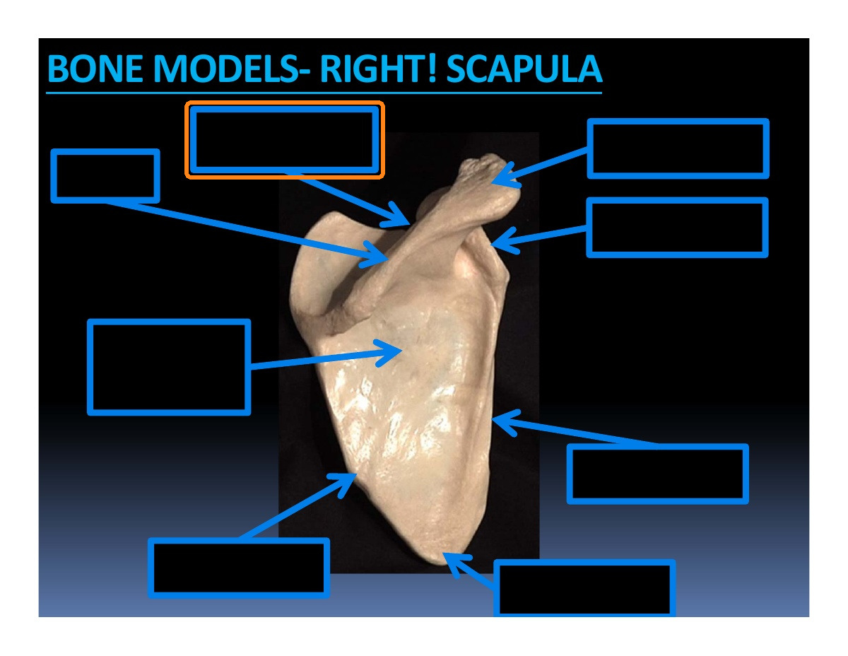 Identify the highlighted structure in the Right Scapula: Posterior View diagram.