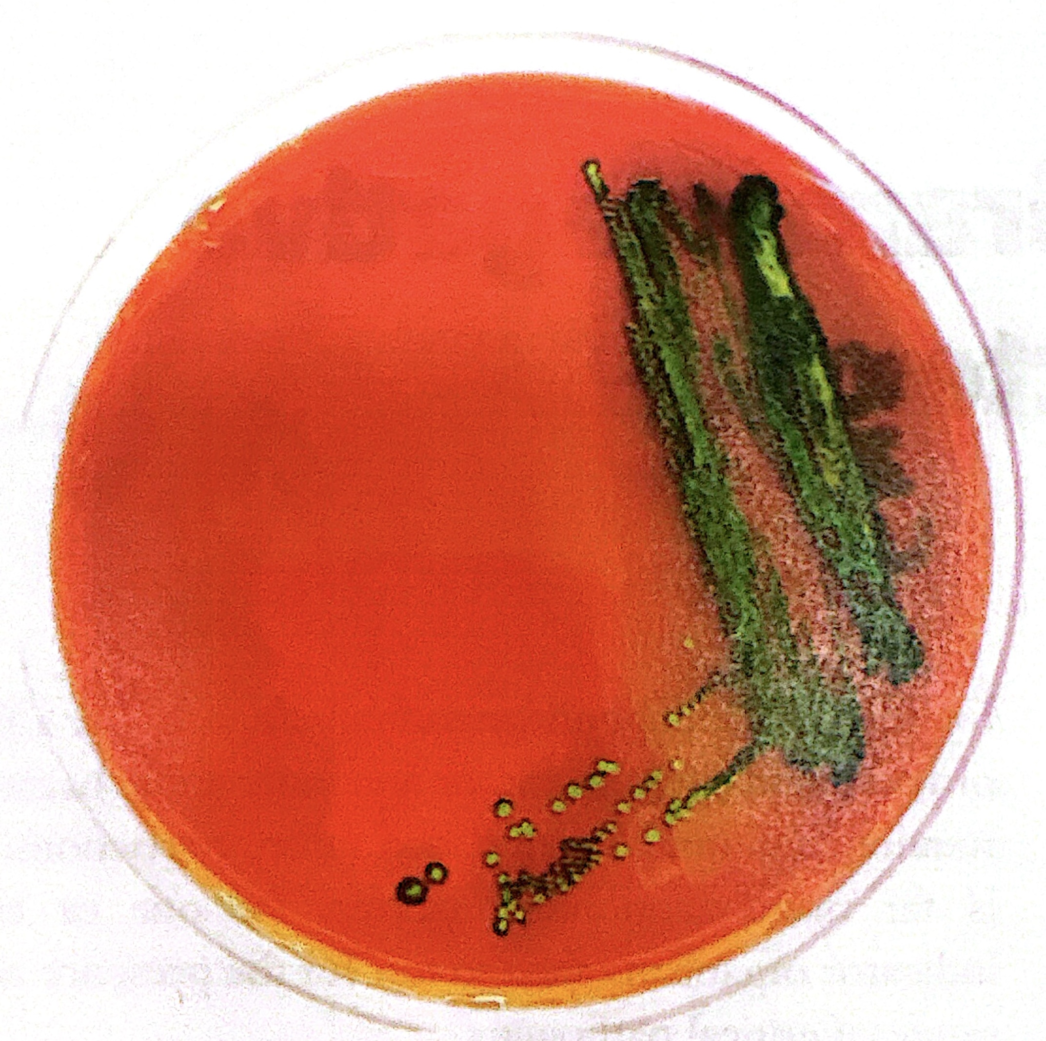 <p>green metallic sheened colonies on EMB</p>