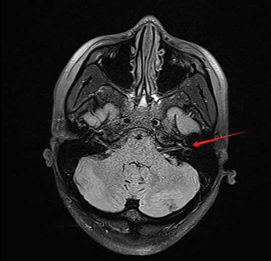 <p>what imaging measure is this? </p>