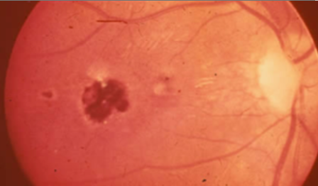<p>disease and severity or state</p>
