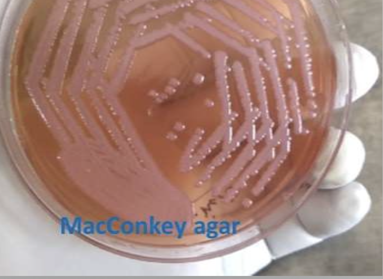 <p>SKIN/SOFT TISSUE INFECTIONS, URINARY TRACT INFECTIONS, MENINGITIS, BACTEREMIA, PNEUMONIA</p><p>purple colonies on macconkey and saccharolytic (aka breaking down sugars) makes it look like lactose fermenting</p><p>Purple bauman dress </p>
