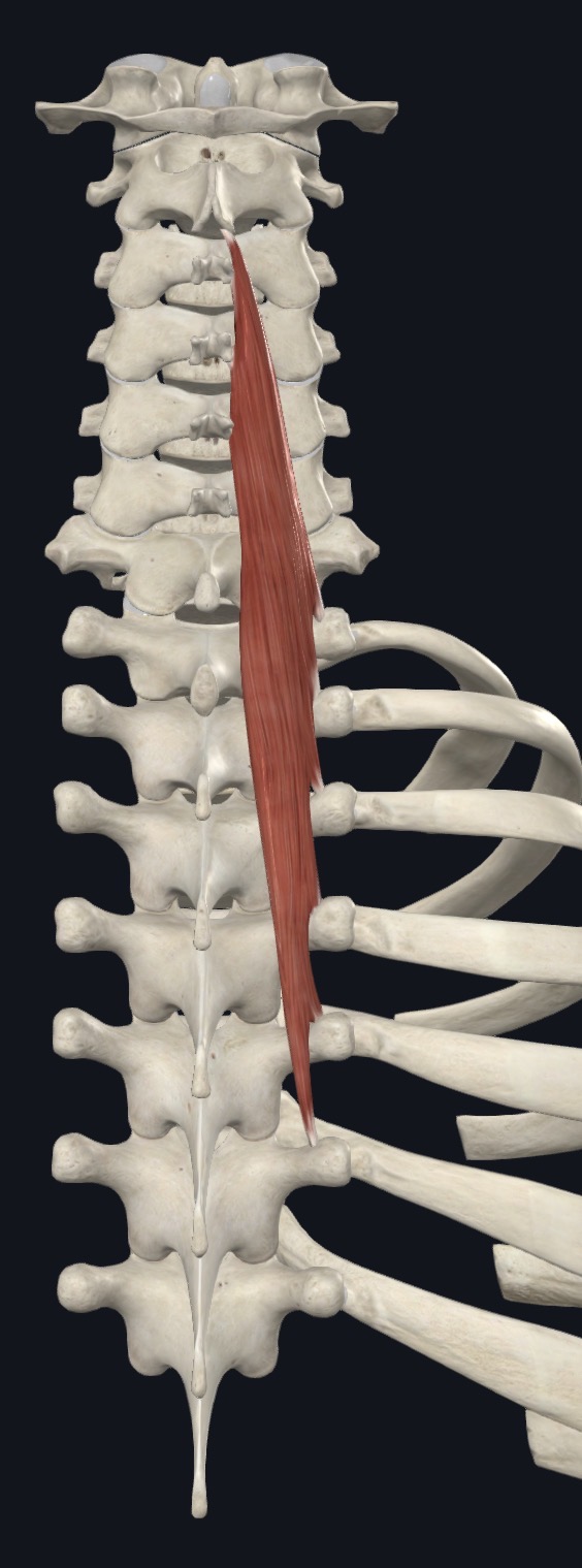 <p>Semispinalis cervicis <strong>Origin</strong></p>