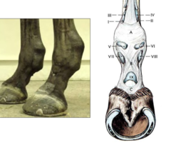 <p>What is digital flexor tendon sheath tenosynovitis?</p>