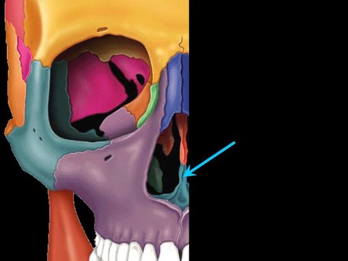 term image